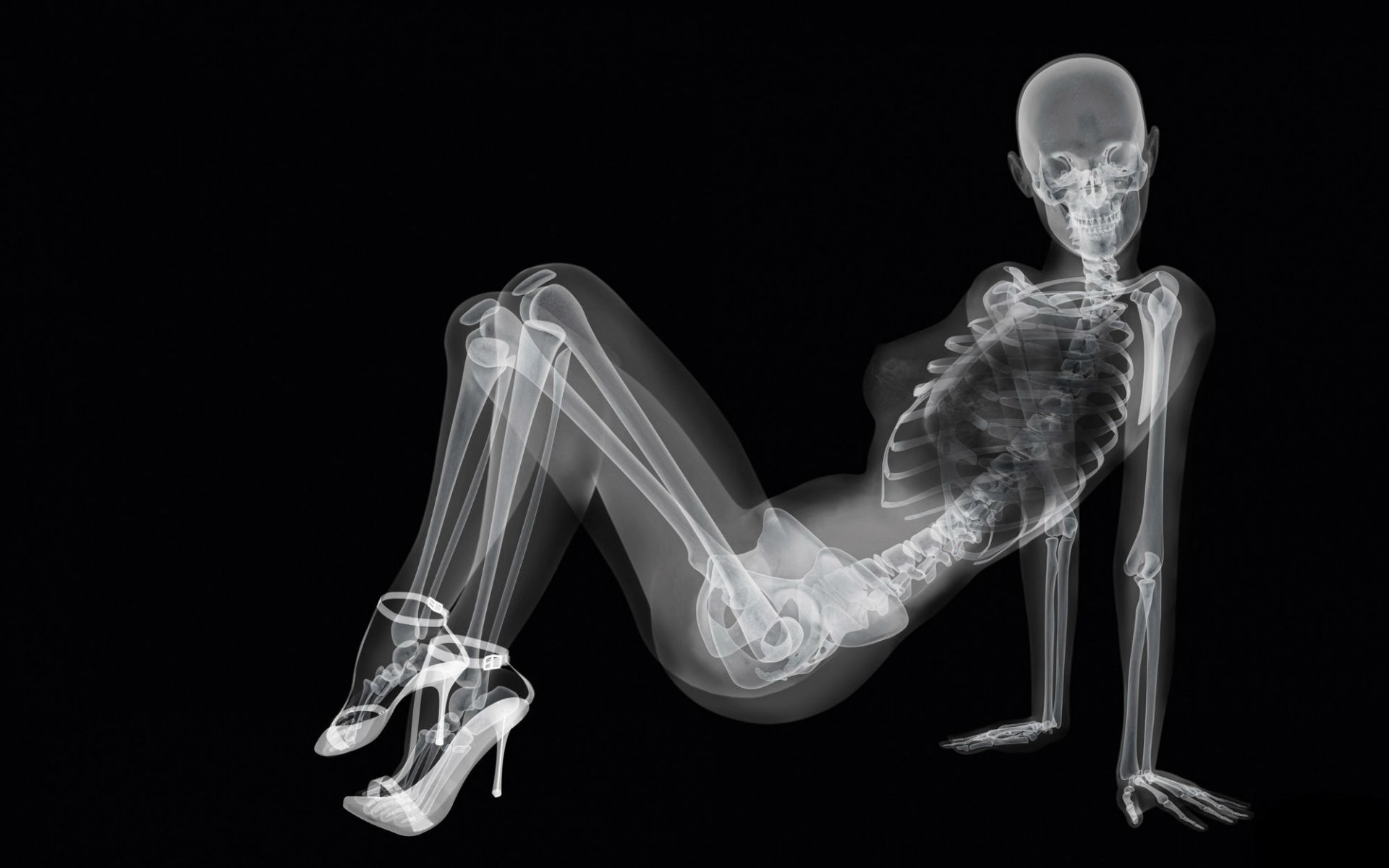 Снимок рентгена девушки на каблуках
